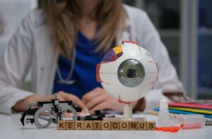An eye doctor sits in the background, while the desk in front displays a series of blocks that spell "keratoconus" along with eye care tools.